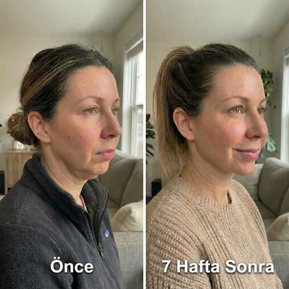 Fivelza™ Kolajen Yüz ve Çene Şekillendirici Maske